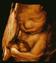 27 неделя беременности: новая жизнь уже близко.